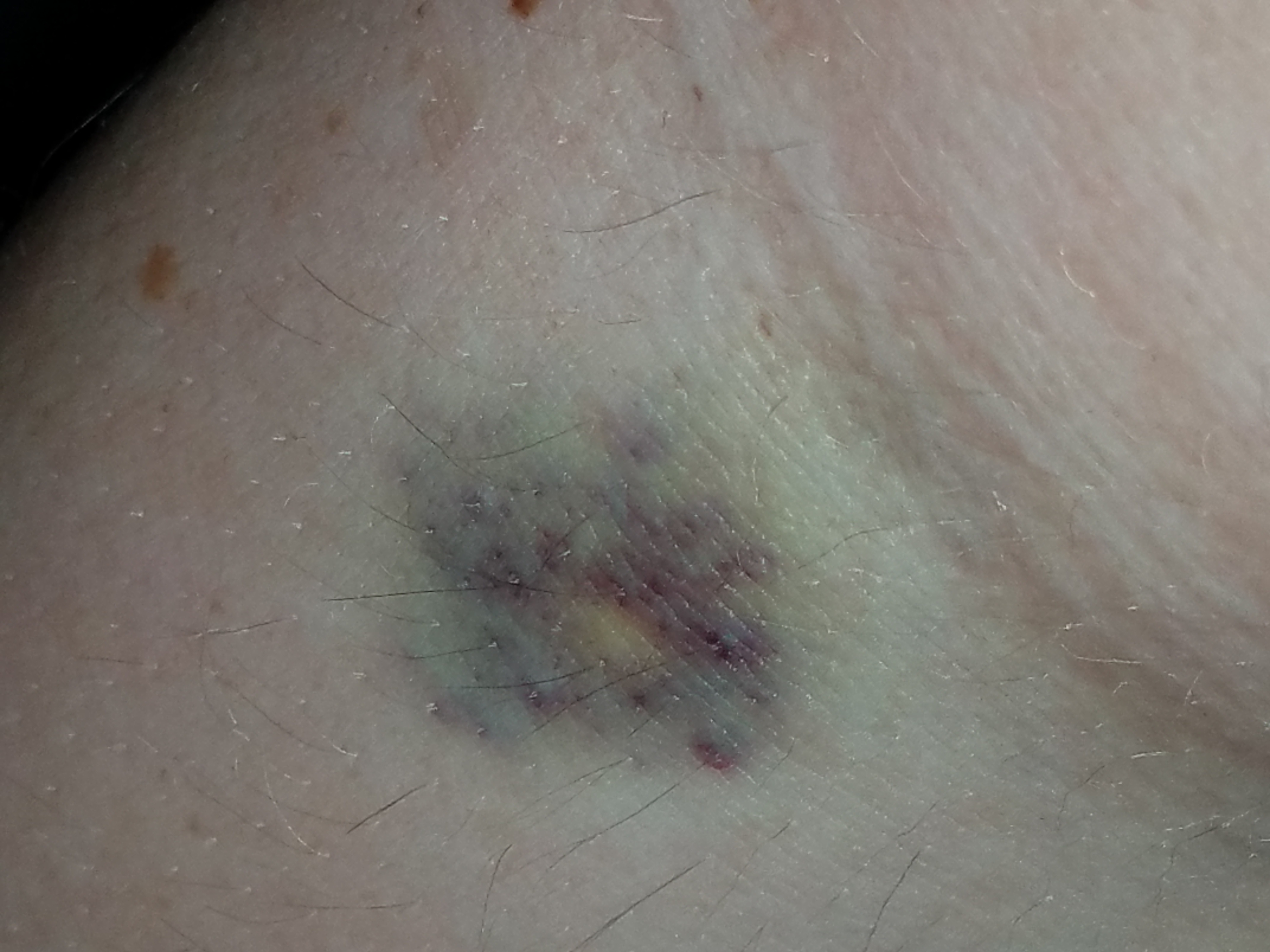 LabCorp Reviews 159 Reviews of Sitejabber